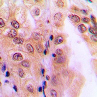 PPP2R5D Rabbit Polyclonal Antibody
