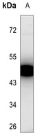 PKA C gamma Rabbit Polyclonal Antibody