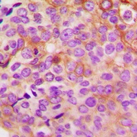 PKA C gamma Rabbit Polyclonal Antibody