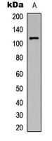 PKC mu (Phospho-Y463) Antibody