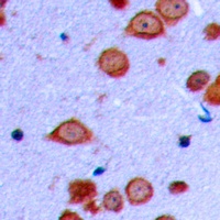 PRKD2 (Phospho-S876) Rabbit Polyclonal Antibody