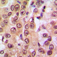 PTEN (Phospho-S370) Rabbit Polyclonal Antibody
