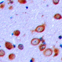 PTHR1 Rabbit Polyclonal Antibody