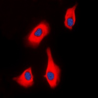 PTHR1 Rabbit Polyclonal Antibody