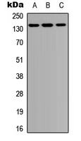 PTPD1 Rabbit Polyclonal Antibody