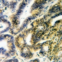 PTPD1 Rabbit Polyclonal Antibody