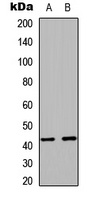 RAD51C Rabbit Polyclonal Antibody