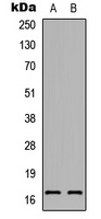 RAMP1 Rabbit Polyclonal Antibody