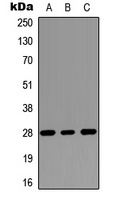 RASSF3 Rabbit Polyclonal Antibody