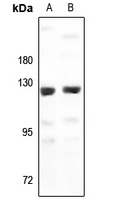 G15 Rabbit Polyclonal Antibody