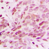 G15 Rabbit Polyclonal Antibody