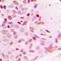 NF-kappaB p65 (Phospho-T254) Antibody