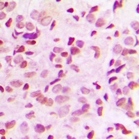 NF-kappaB p65 (Phospho-T435) Antibody