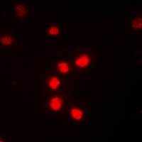 NF-kappaB p65 (Phospho-T435) Antibody