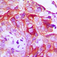 RET (Phospho-Y1062) Antibody