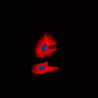 RET (Phospho-Y1062) Antibody
