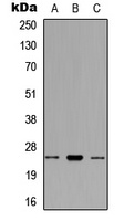 RNF125 Rabbit Polyclonal Antibody