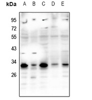 RNF138 Rabbit Polyclonal Antibody