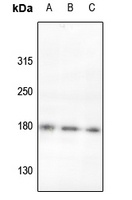 ROBO2 Rabbit Polyclonal Antibody