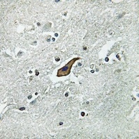 ROBO2 Rabbit Polyclonal Antibody