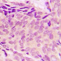 RPL37A Rabbit Polyclonal Antibody