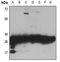 RPL7 Rabbit Polyclonal Antibody