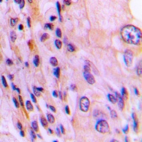 Rhotekin Rabbit Polyclonal Antibody