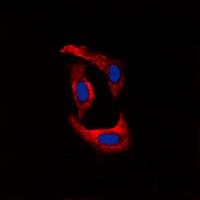 Ryanodine Receptor 2 (Phospho-S2808) Antibody