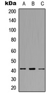SDCCAG8 Rabbit Polyclonal Antibody