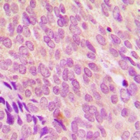 SDCCAG8 Rabbit Polyclonal Antibody
