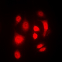 SGK1/2 (Phospho-T256/253) Antibody