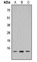 SH2D1A Rabbit Polyclonal Antibody