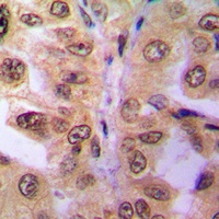 SIAH2 Rabbit Polyclonal Antibody