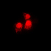 SIAH2 Rabbit Polyclonal Antibody