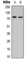 SLC6A16 Rabbit Polyclonal Antibody