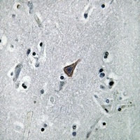 SLC6A16 Rabbit Polyclonal Antibody