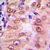 SMAD1/9 (Phospho-S465/467) Antibody