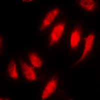 SMAD2 (Phospho-S467) Antibody