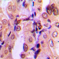 SMAD2 (Phospho-S465) Antibody