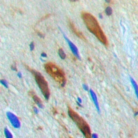 SMAD3 (Phospho-T179) Rabbit Polyclonal Antibody