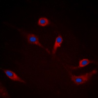 Alpha-synuclein (Phospho-S129) Antibody