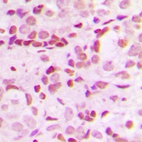 SP1 (Phospho-T453) Antibody