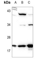 STMN1 Rabbit Polyclonal Antibody