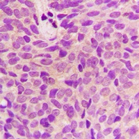 STMN1 Rabbit Polyclonal Antibody