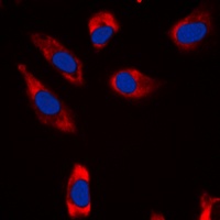 STMN1 Rabbit Polyclonal Antibody