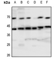 Tachykinin Receptor 1 Rabbit Polyclonal Antibody