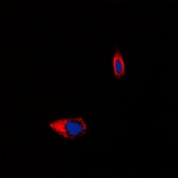 Tachykinin Receptor 1 Rabbit Polyclonal Antibody