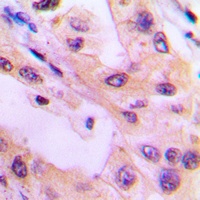 ACK1 (Phospho-Y284) Antibody