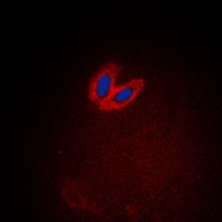ACK1 (Phospho-Y284) Antibody