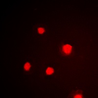 p53 (Phospho-S392) Antibody